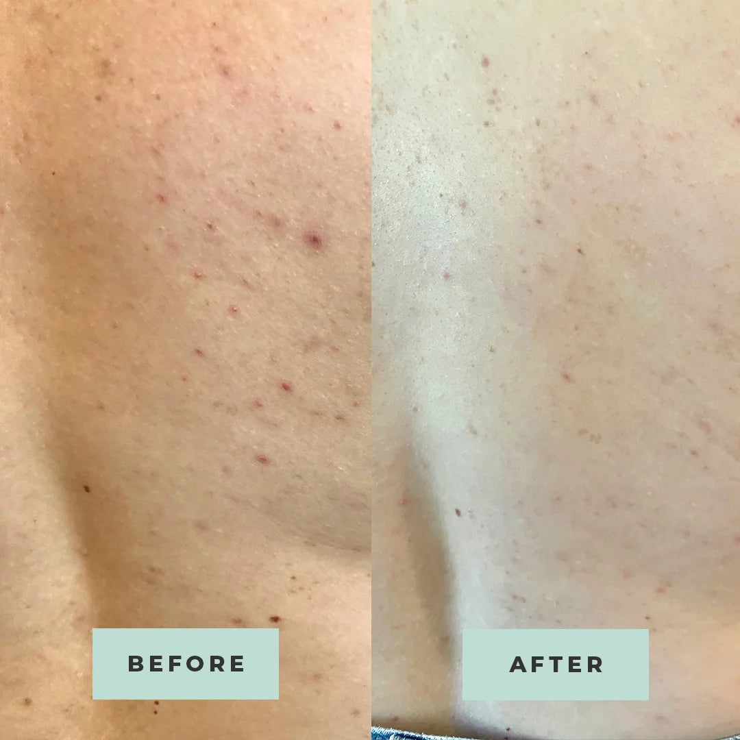 Oregano-powered Bum + Body Cream Kit of 2 Z7877